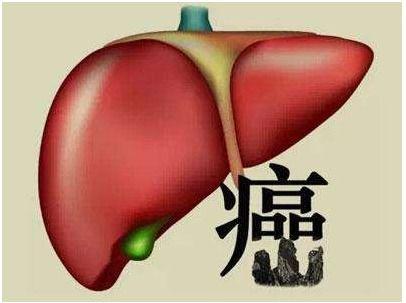 肝癌晚期可以吃小瓜,小瓜助力健康养生